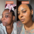Sérum Anti Tache Visage