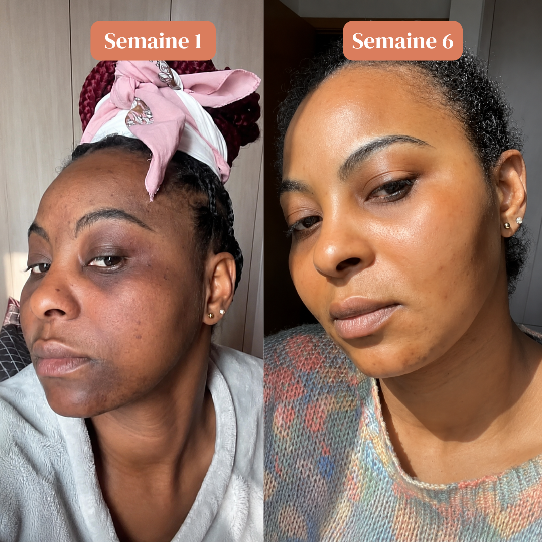 Sérum Anti Tache Visage