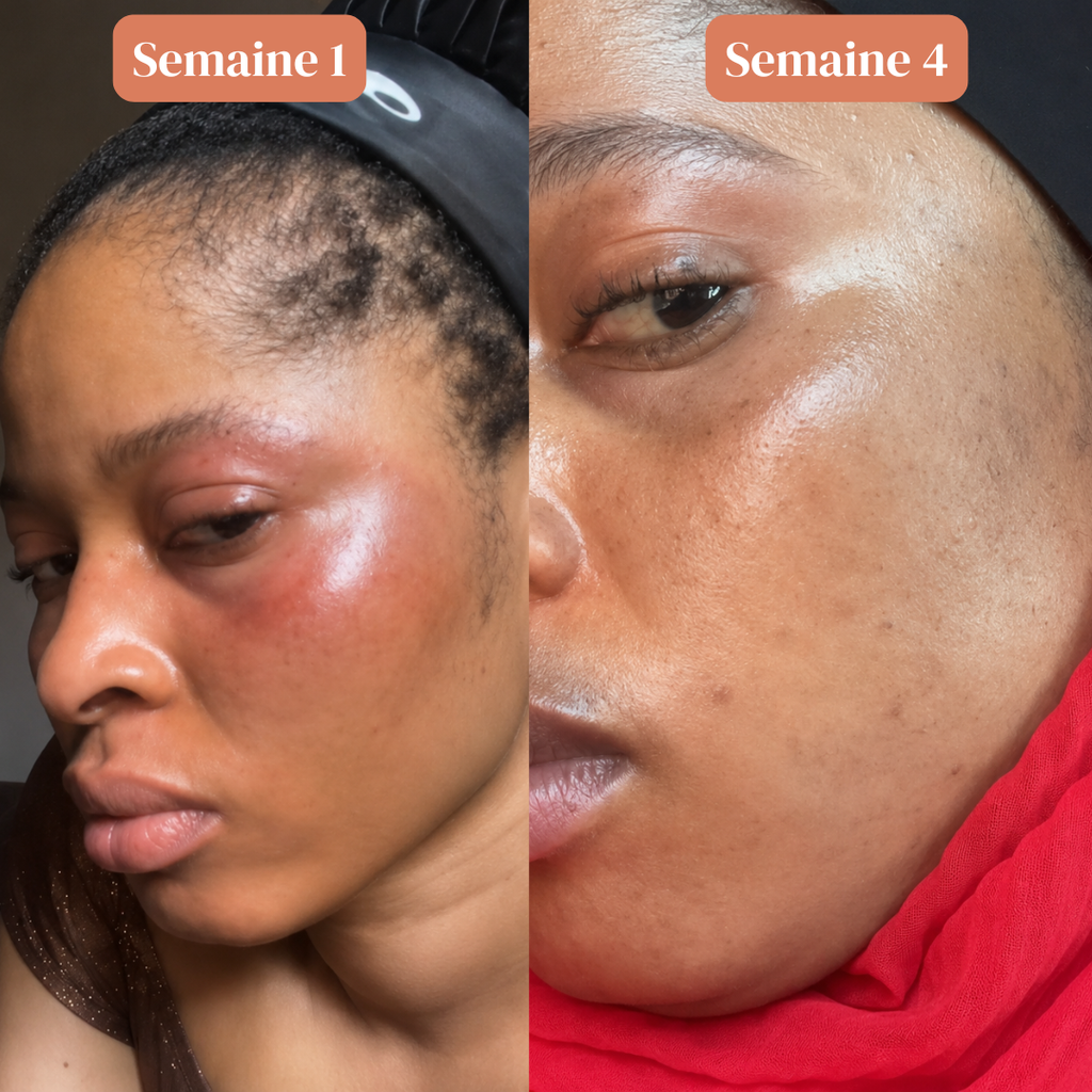Sérum Anti Tache Visage