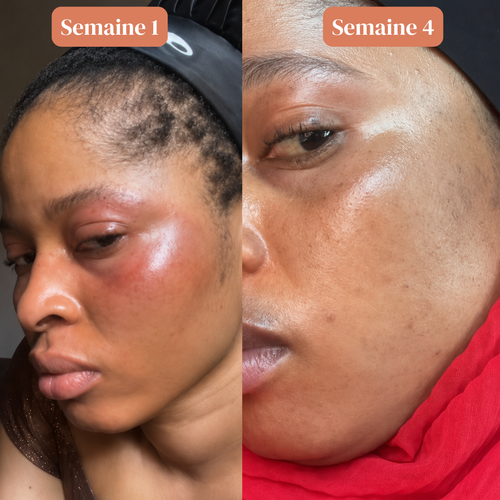 Sérum Anti Tache Visage