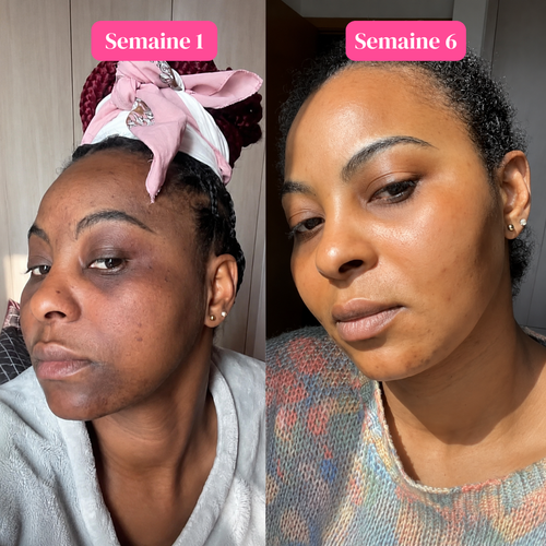Duo Anti-Taches - Visage