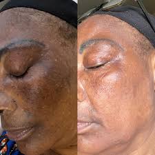  Khadija, 52 ans 